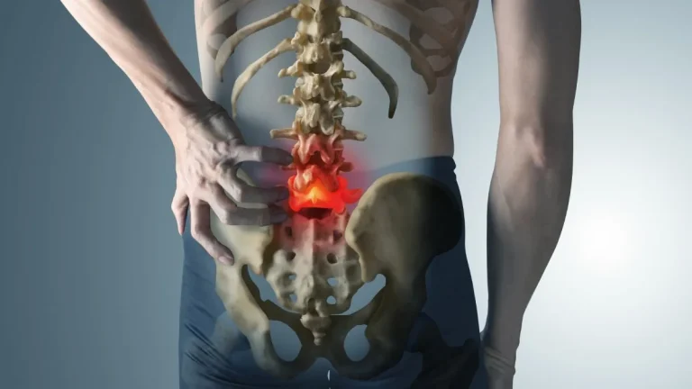 🧠 Neck and Low Back Pain: Not Every Spine Problem Requires Surgery